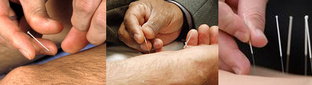 Healing with Acupuncture